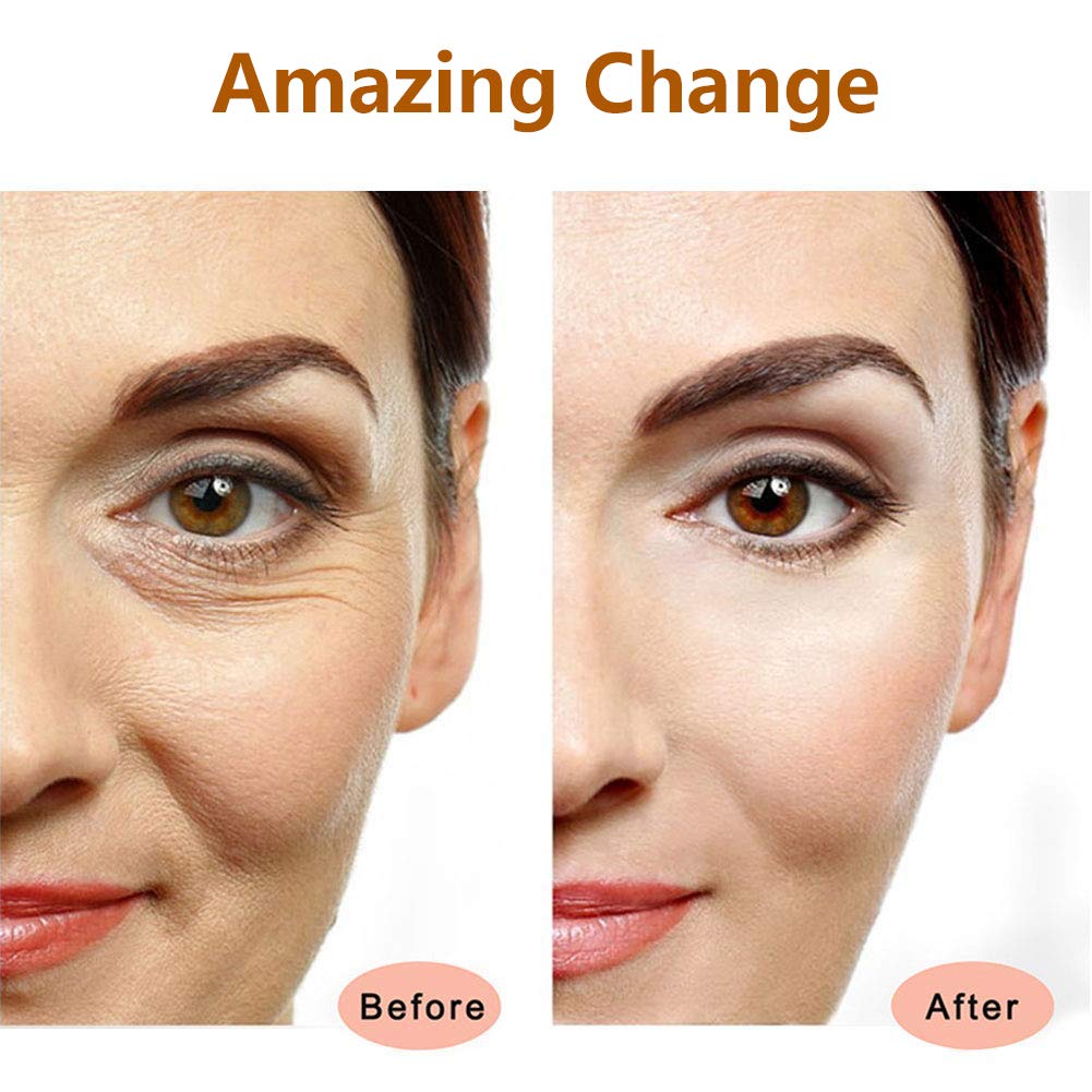 Electric Face Massage Roller, Golden 3D Roller Electric Facial Roller and T Shape Facial Roller Massager Kit, Electric Massage Roller for Puffiness Relief (Gold)